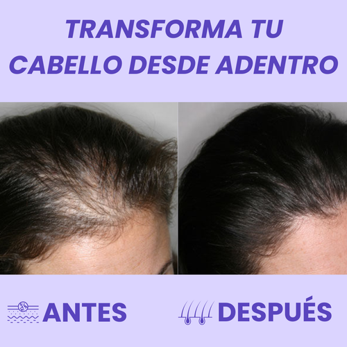 Masticables Para el Crecimiento del Cabello / Solara™